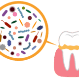 歯周病は「磨いてるつもり」じゃ防げない？〜セルフケアとプロケアの違い、正しく知っていますか？〜