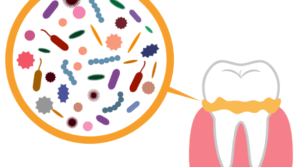 歯周病は「磨いてるつもり」じゃ防げない？〜セルフケアとプロケアの違い、正しく知っていますか？〜