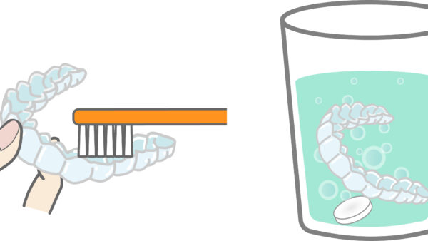 入れ歯やリテーナーは水だけじゃダメ？〜洗浄剤が必要な本当の理由〜